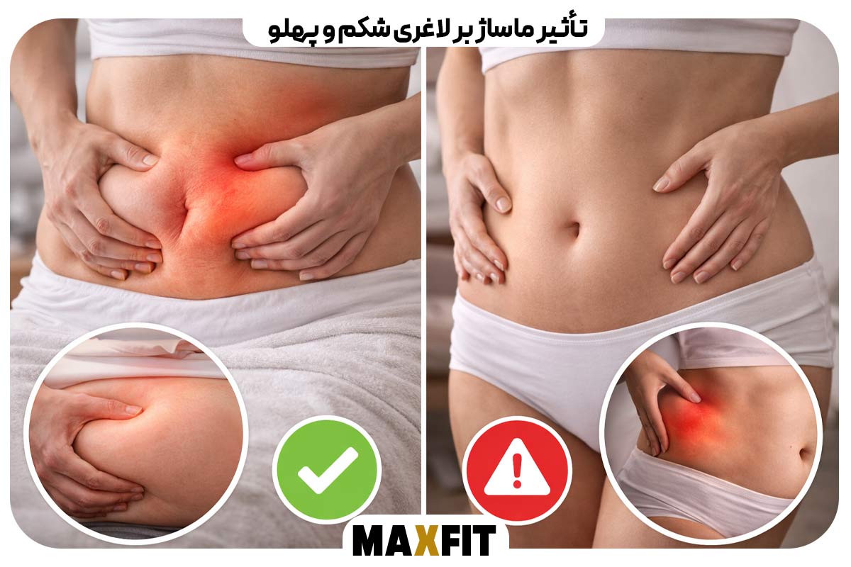 The effect of massage on slimming the abdomen and sides
