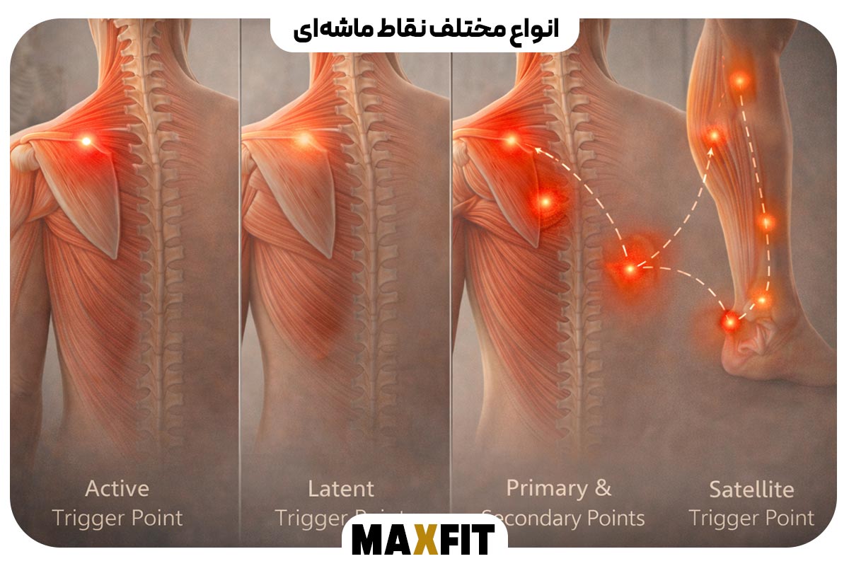 انواع مختلف نقاط ماشه‌ای