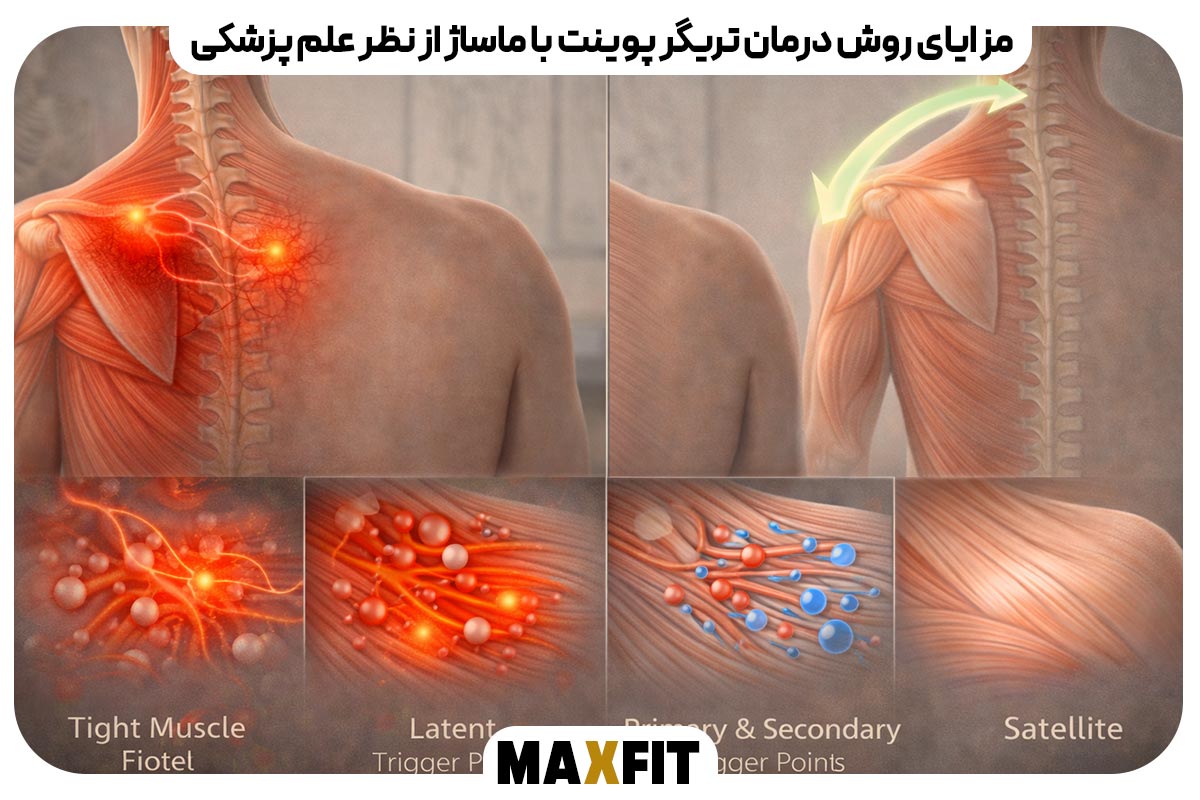 مزایای روش درمان تریگر پوینت با ماساژ از نظر علم پزشکی