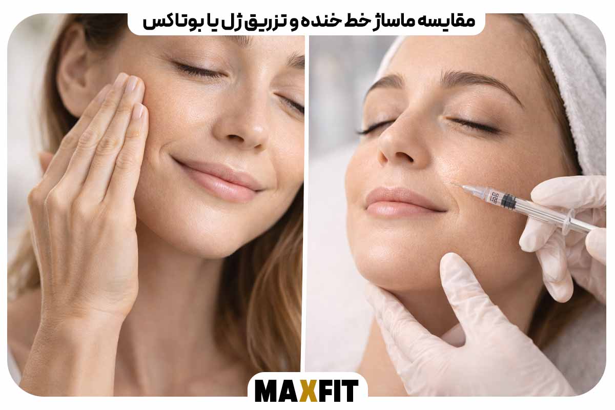 خط خنده