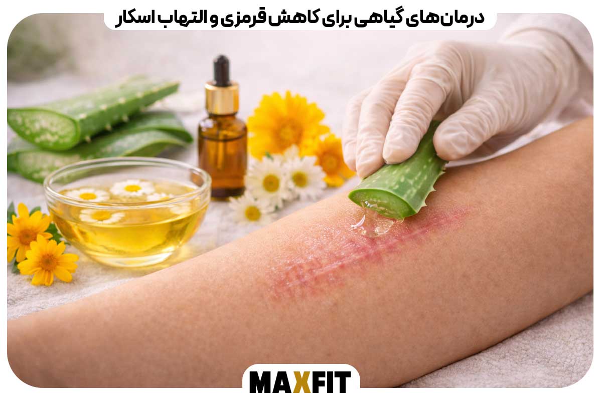 Herbal remedies to reduce scar redness and inflammation