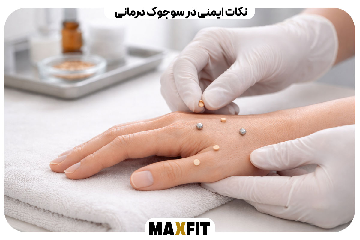 سوجوک تراپی