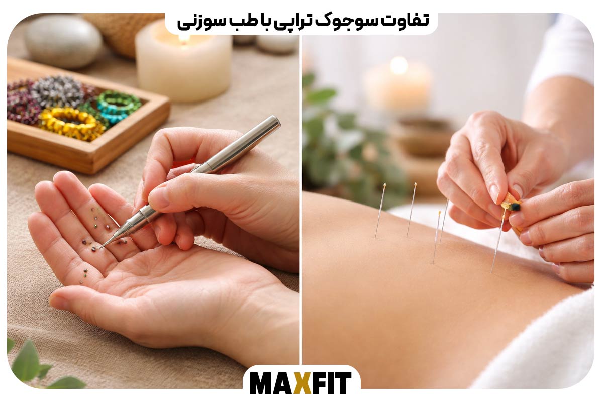 The difference between Sujok therapy and acupuncture