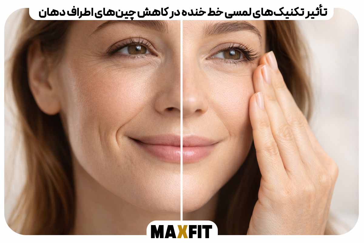 The effect of tactile laugh line techniques on reducing wrinkles around the mouth