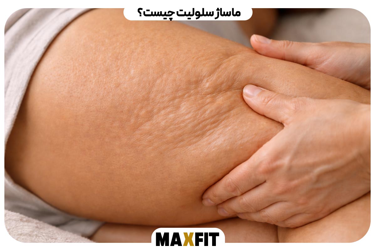 What is cellulite massage? 