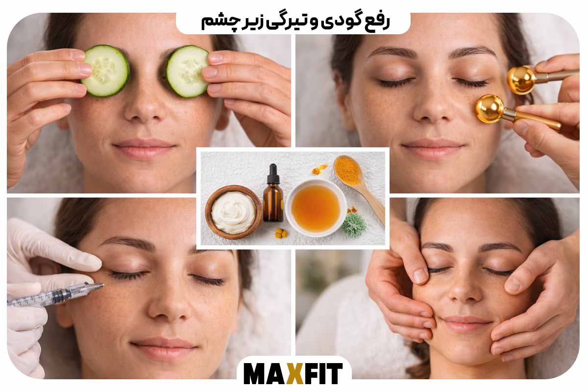 رفع گودی و تیرگی زیر چشم