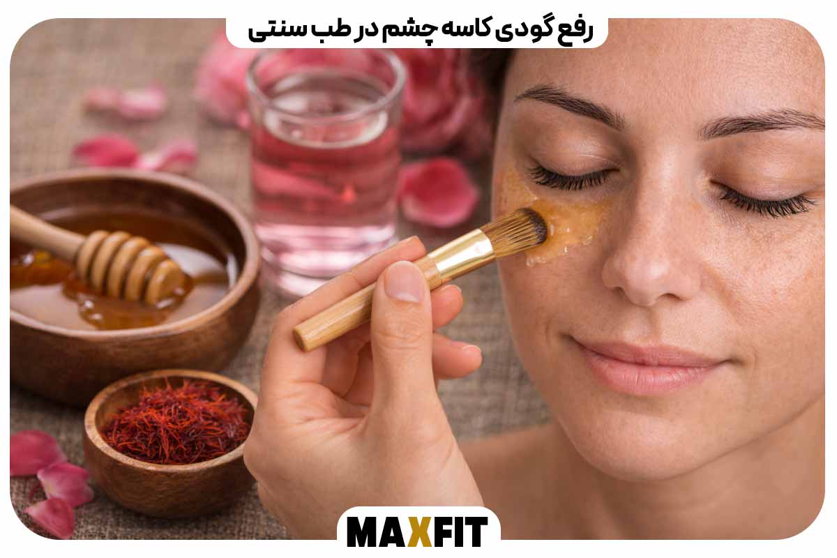 رفع گودی کاسه چشم در طب سنتی