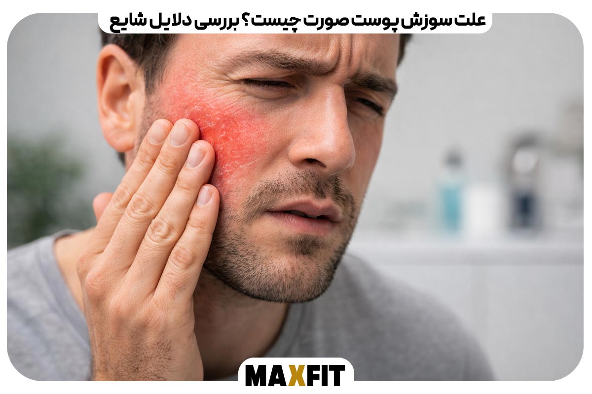 علت سوزش پوست صورت چیست؟ بررسی دلایل شایع