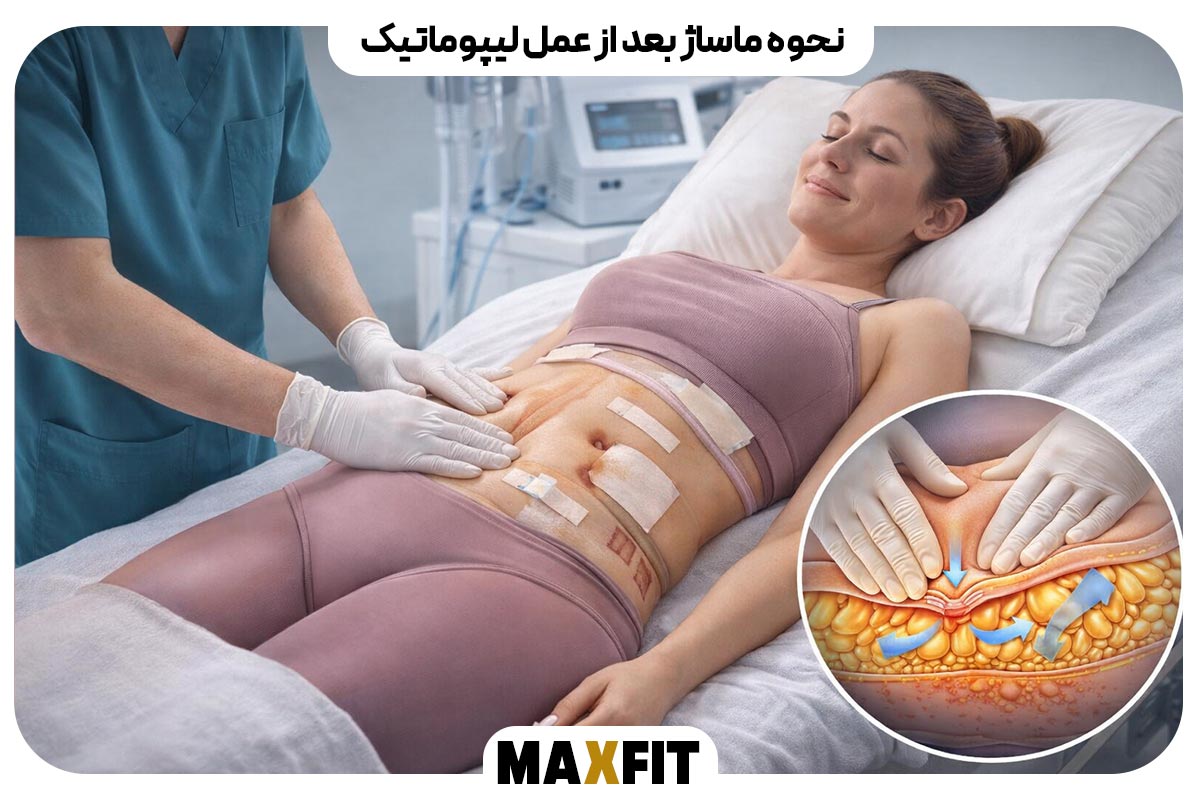 نحوه ماساژ بعد از عمل لیپوماتیک