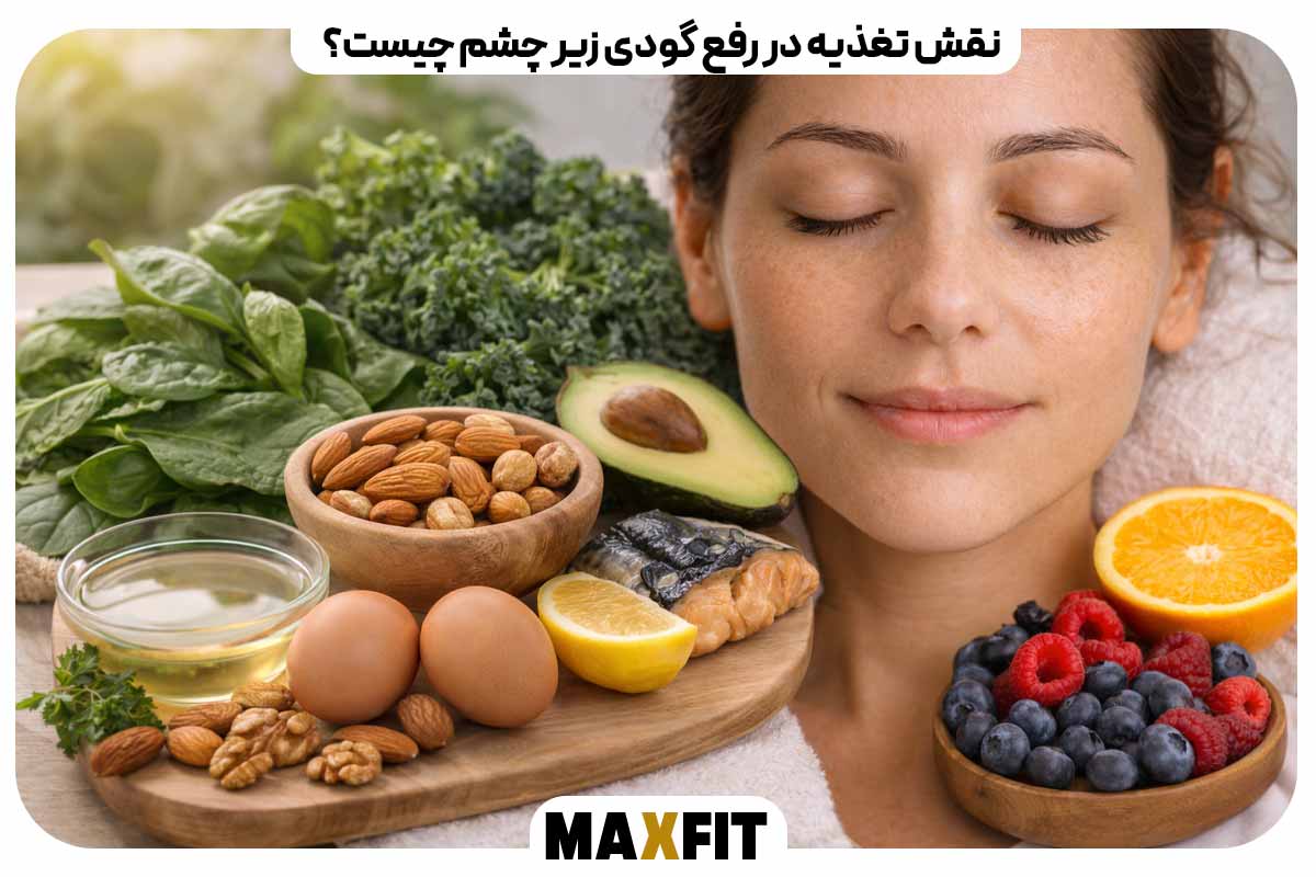 نقش تغذیه در رفع گودی زیر چشم چیست؟