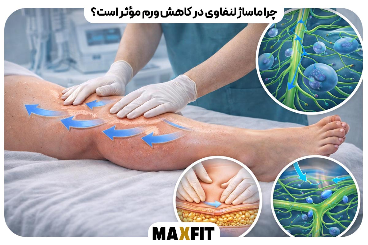 چرا ماساژ لنفاوی در کاهش ورم مؤثر است؟
