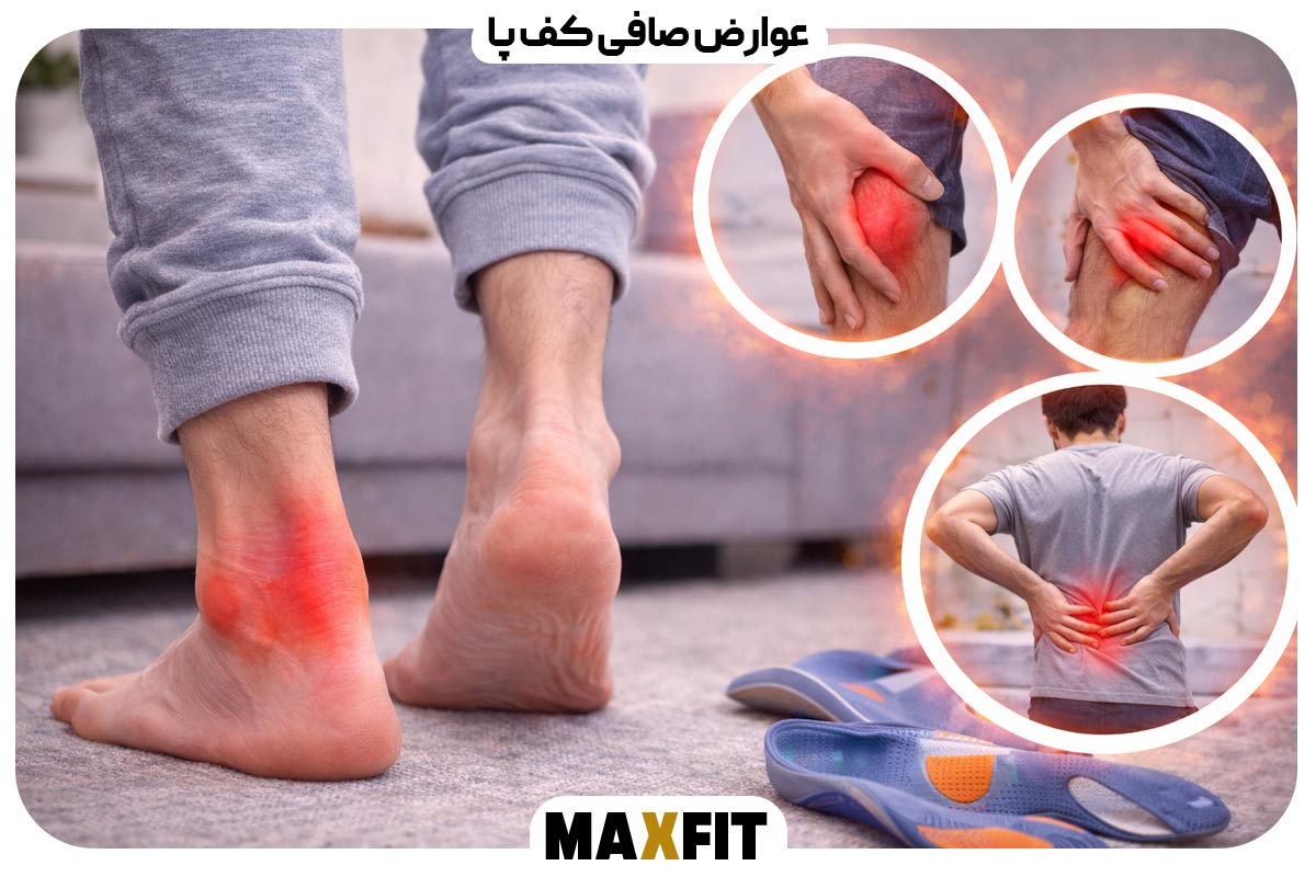 Complications of flat feet