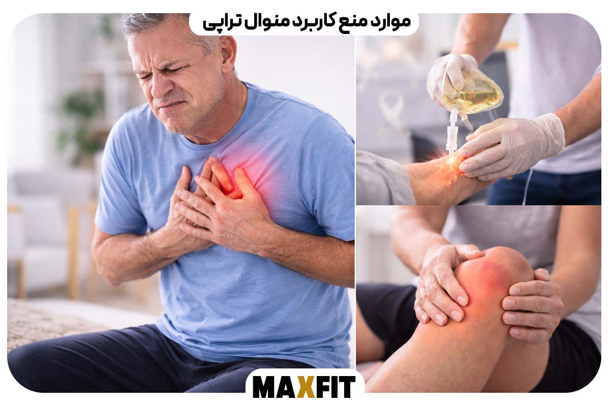 منوال تراپی