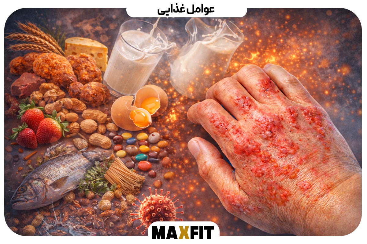 Dietary factors