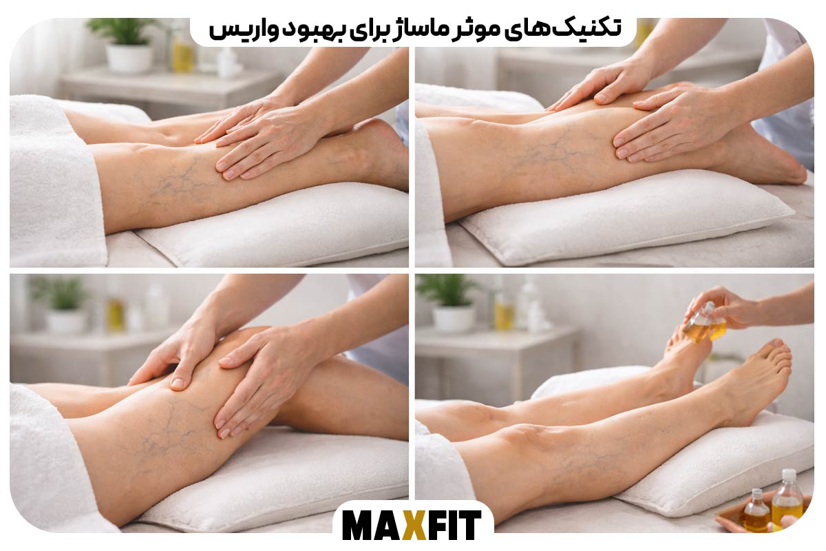 Effective massage techniques to improve varicose veins