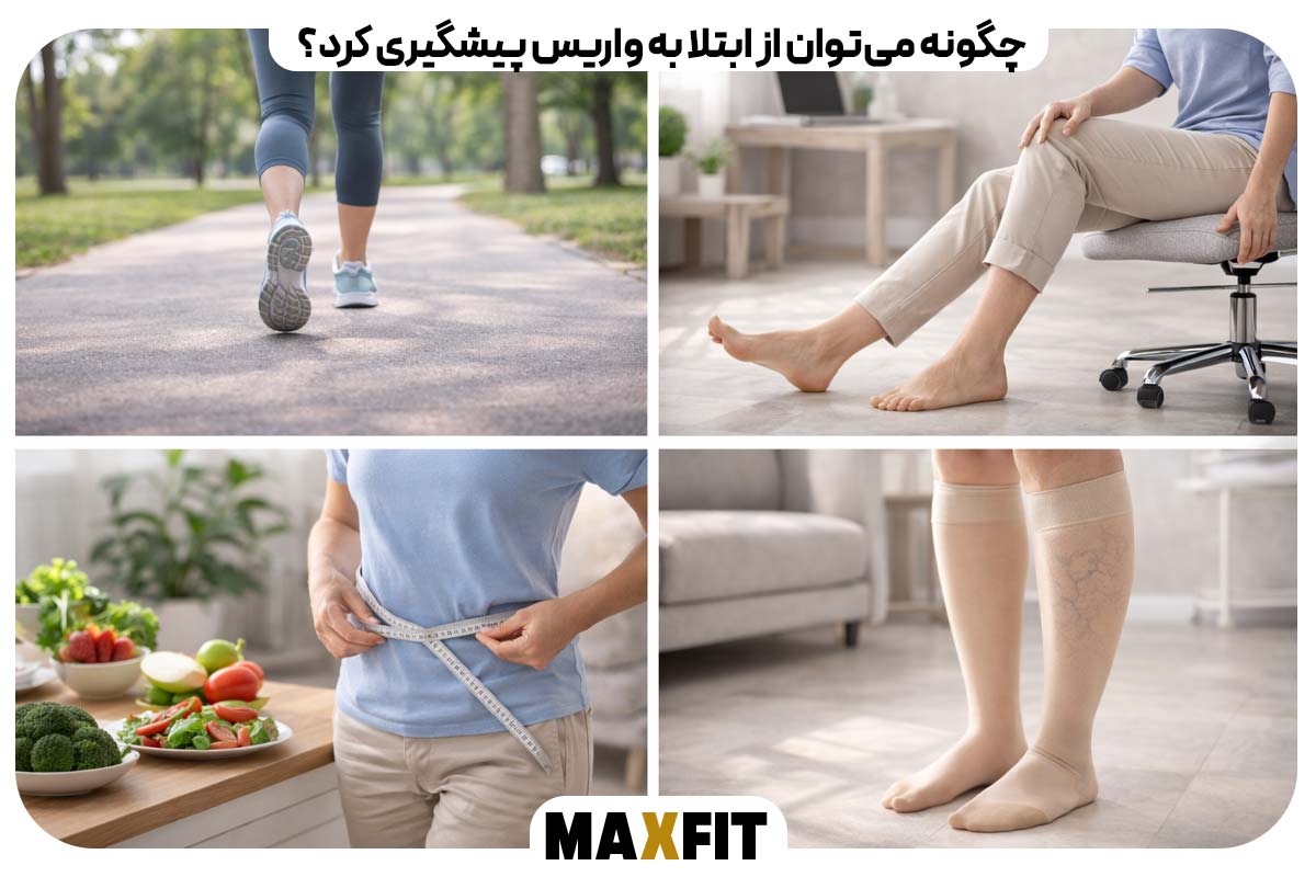 How can you prevent varicose veins?