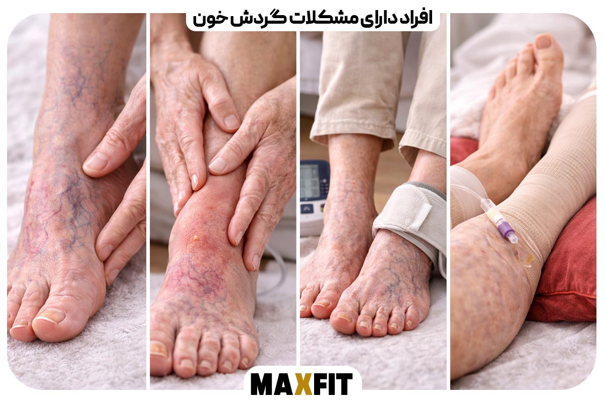 People with circulatory problems