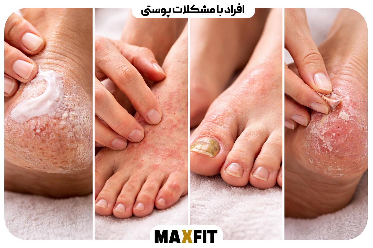 People with skin problems