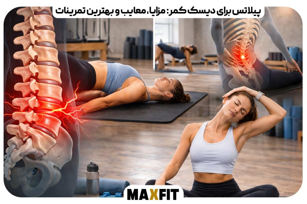 Pilates for lumbar disc Benefits disadvantages and best exercises