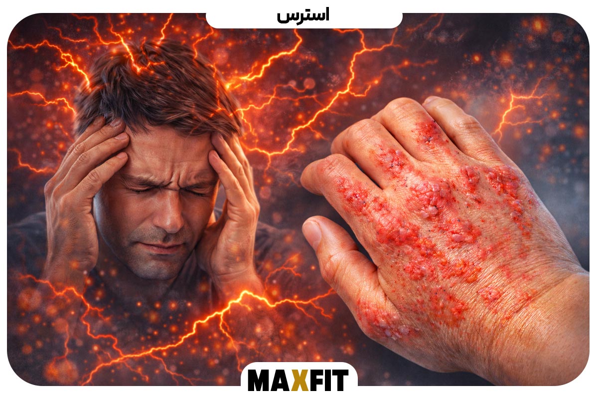 Stress