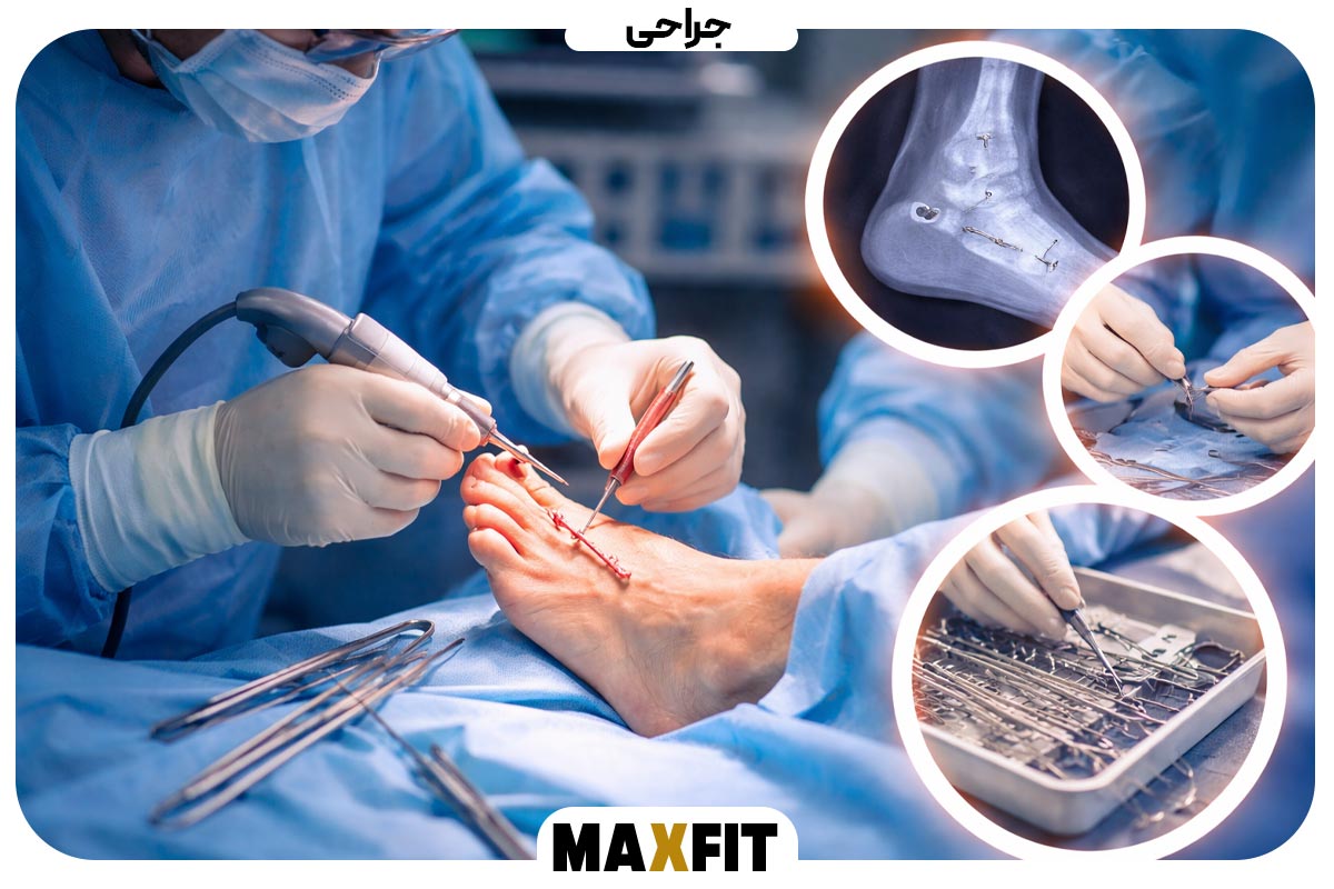 Surgery