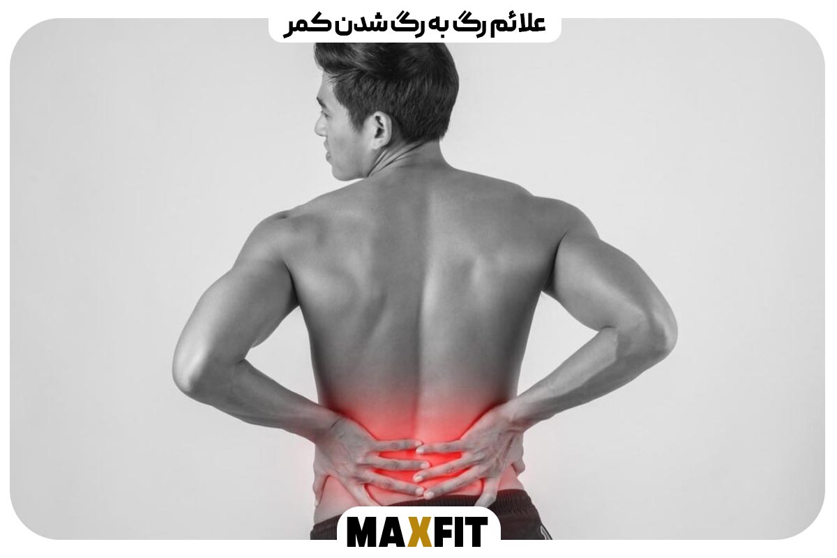 Symptoms of a back sprain