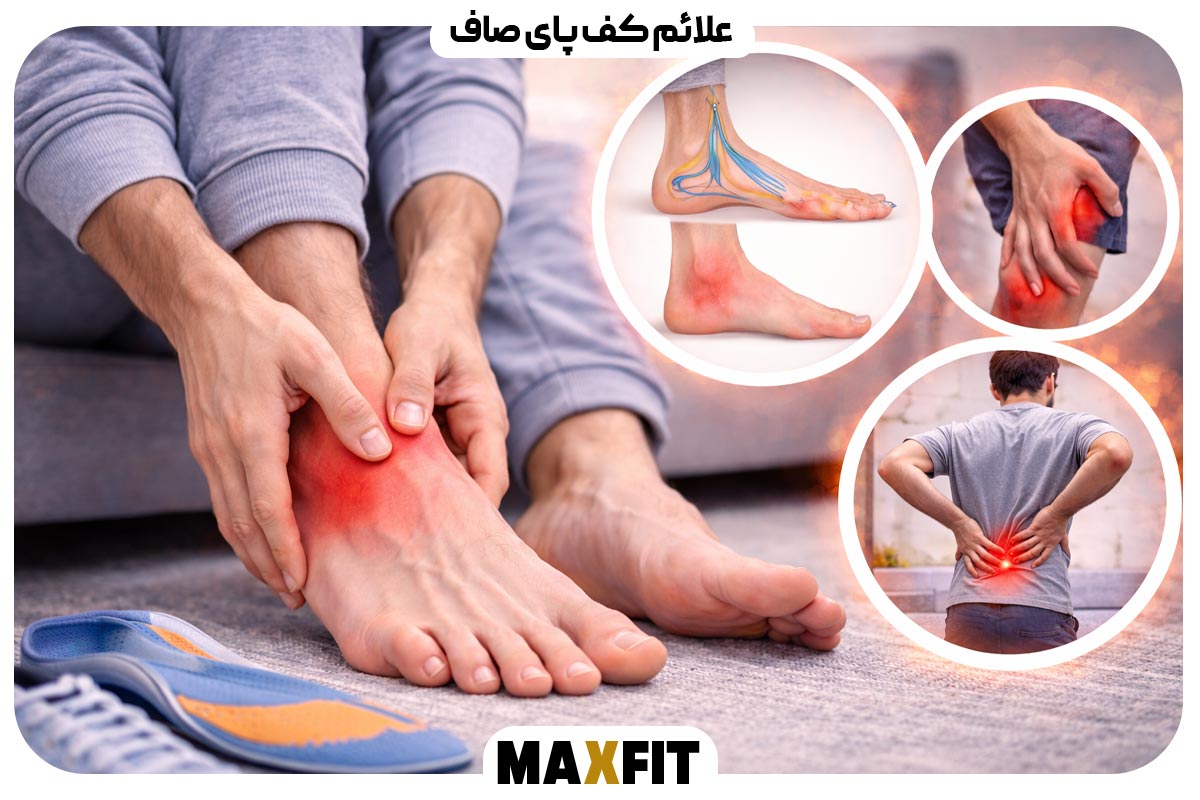 Symptoms of flat feet