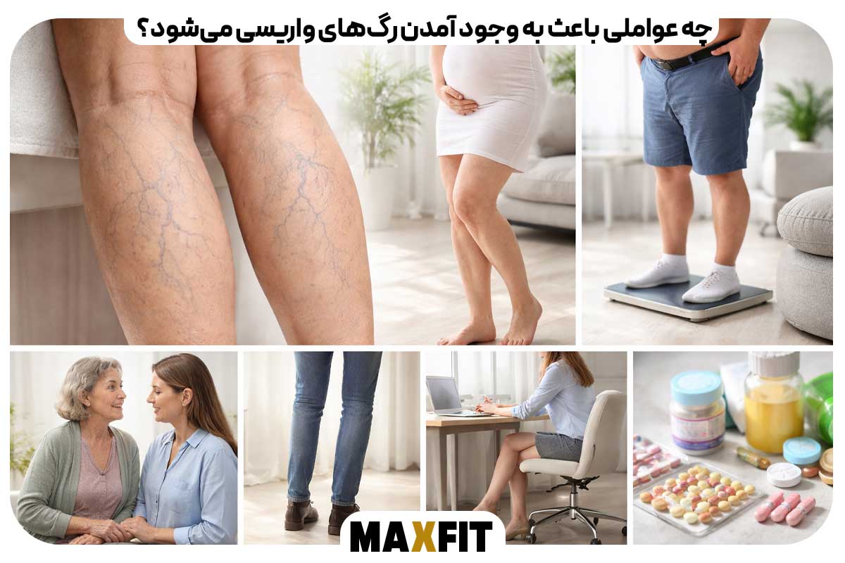 What factors cause varicose veins?
