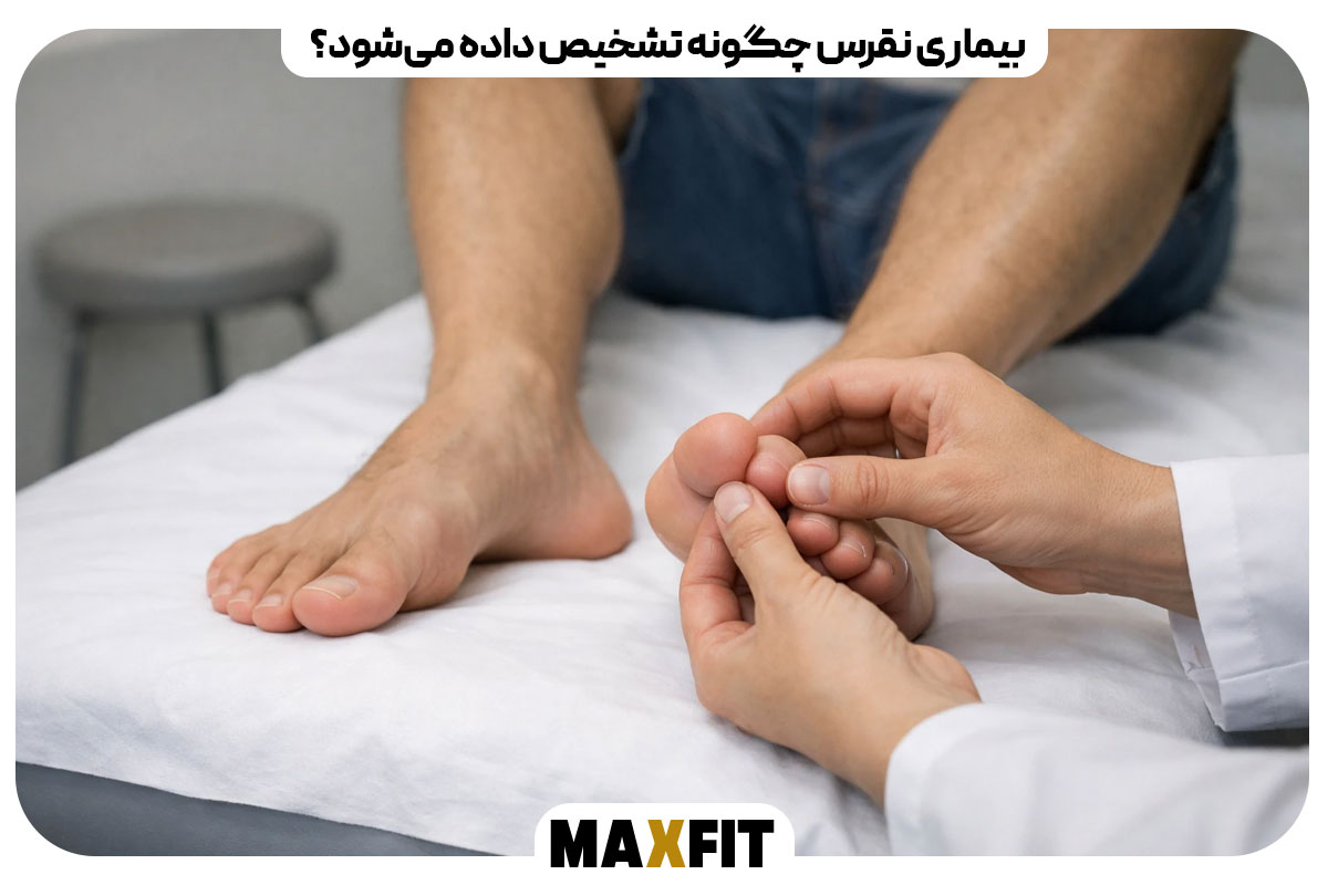 بیماری نقرس چگونه تشخیص داده می‌شود؟