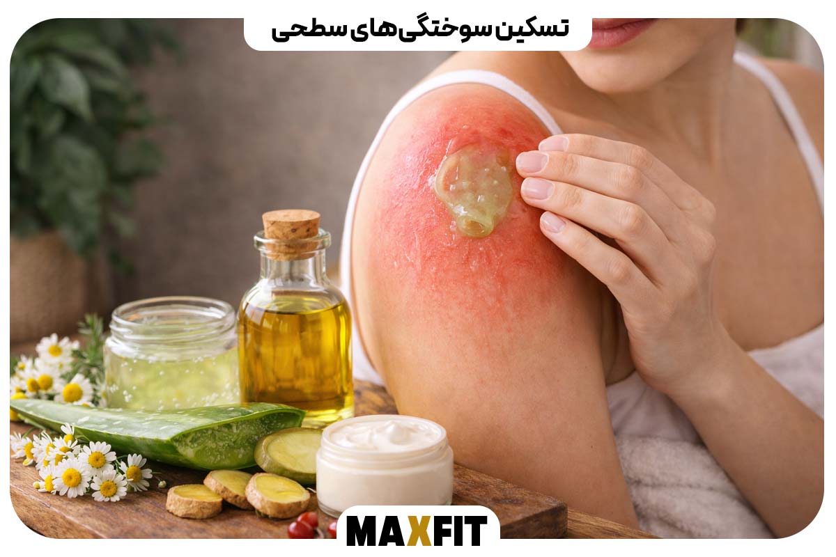 تسکین سوختگی‌های سطحی