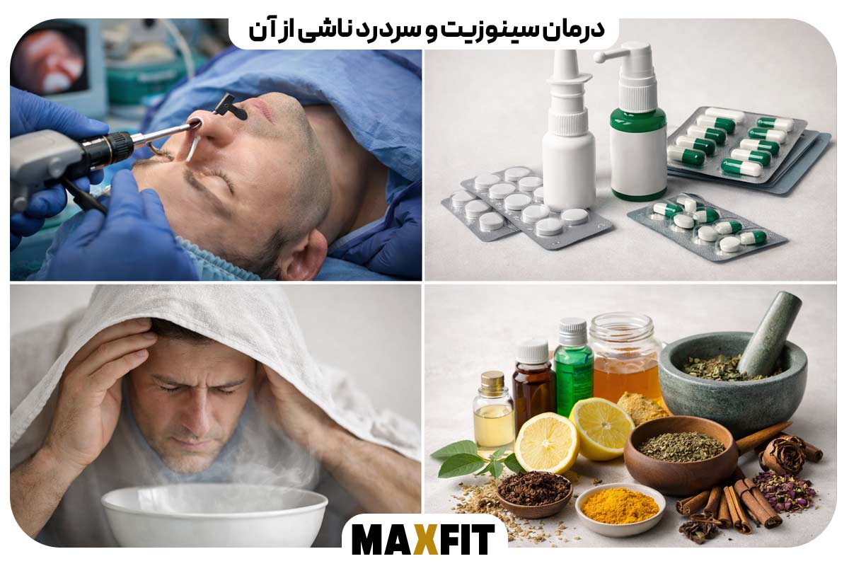 درمان سینوزیت و سردرد ناشی از آن
