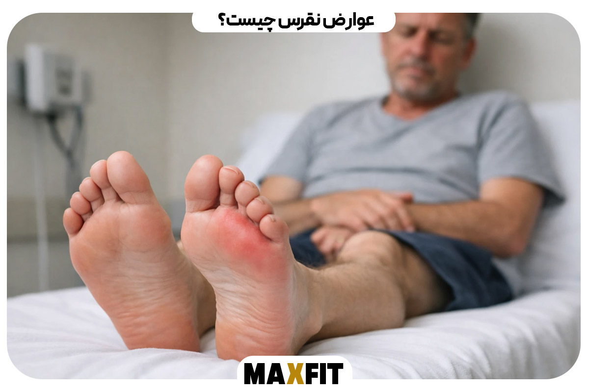 عوارض نقرس چیست؟
