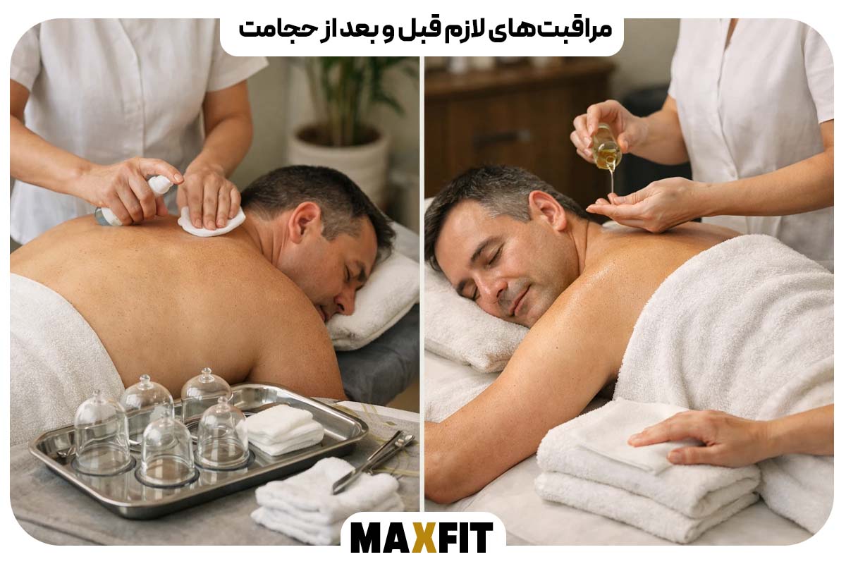 مراقبت‌های لازم قبل و بعد از حجامت
