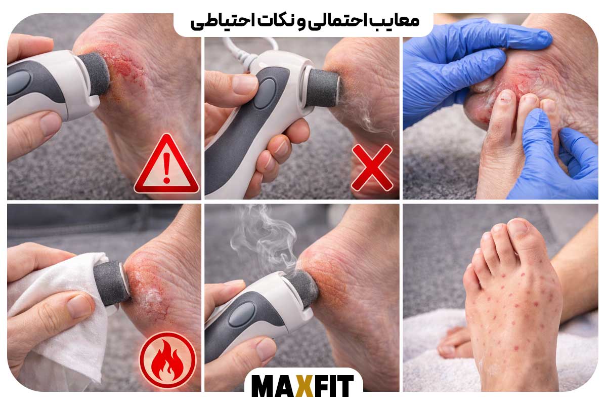 معایب احتمالی و نکات احتیاطی