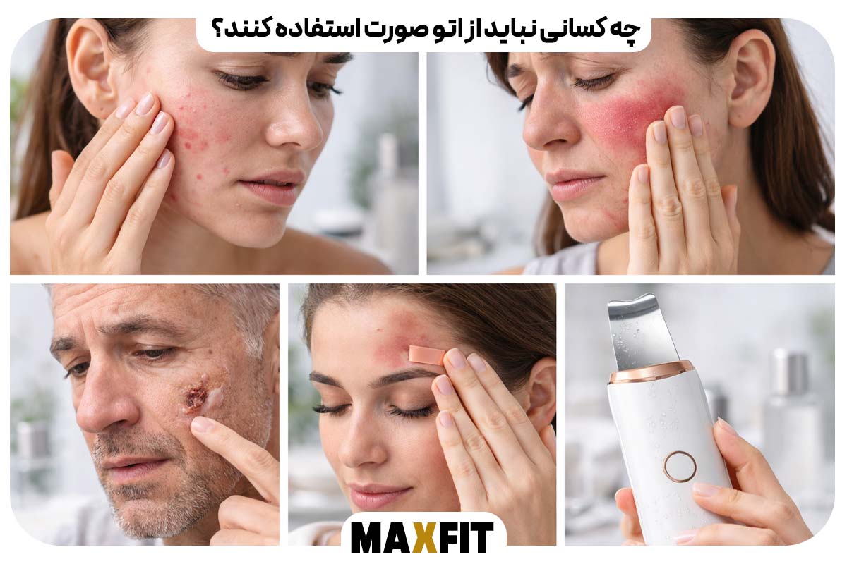 چه کسانی نباید از اتو صورت استفاده کنند؟