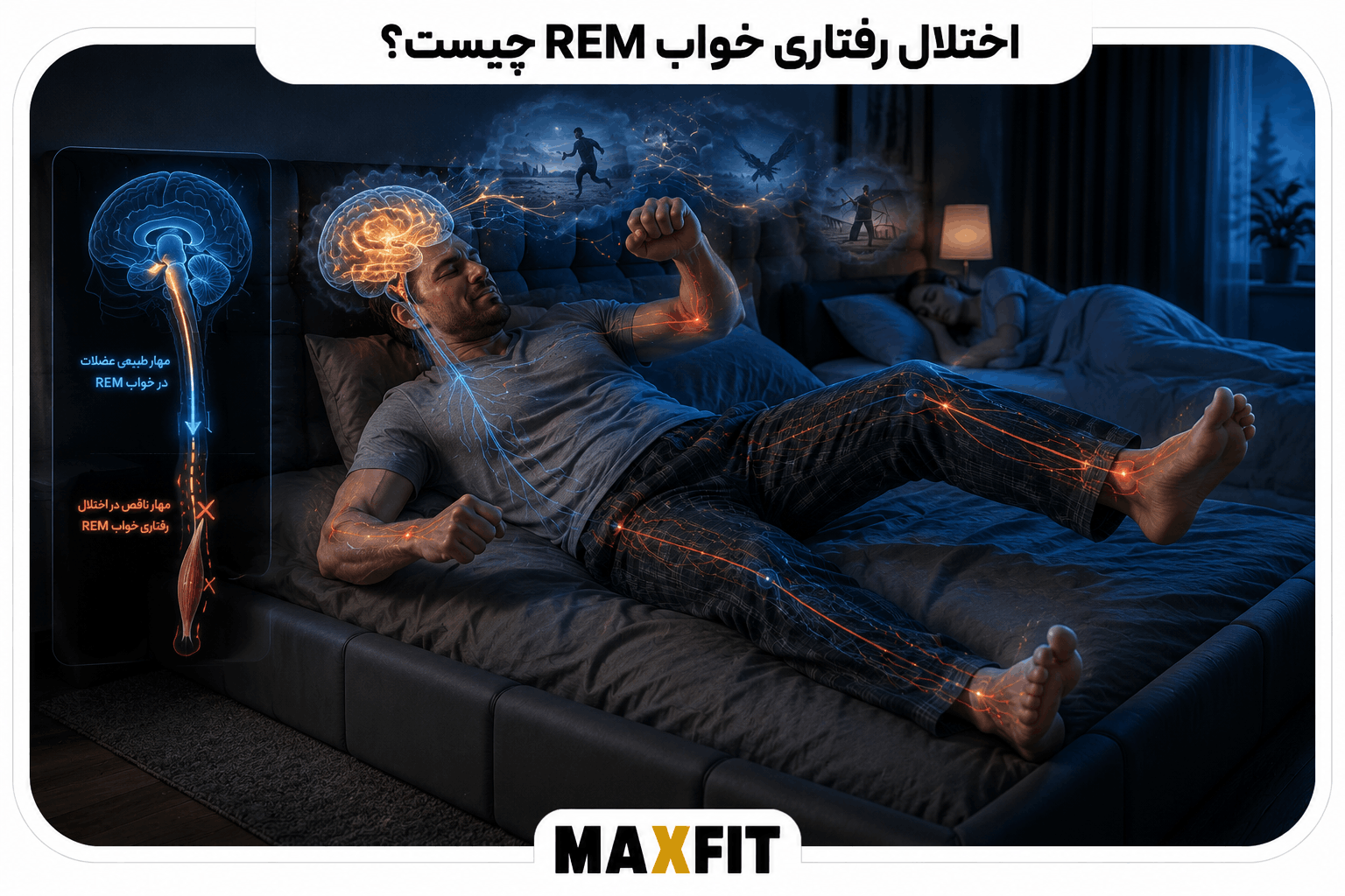 فردی در حال اجرای حرکات رؤیا هنگام خواب به دلیل اختلال رفتاری خواب REM و ناقص‌بودن بی‌حرکتی عضلات